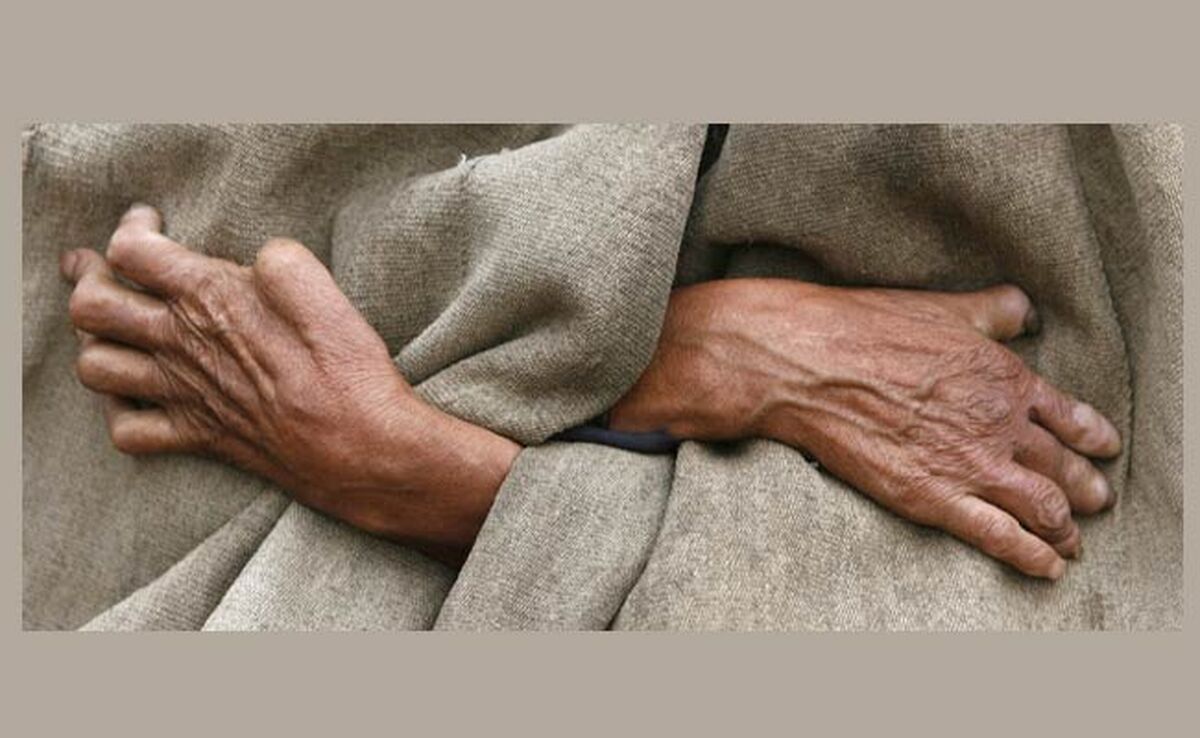 شایعه شیوع جذام در کشور/ باید نگران این بیماری باشیم؟

