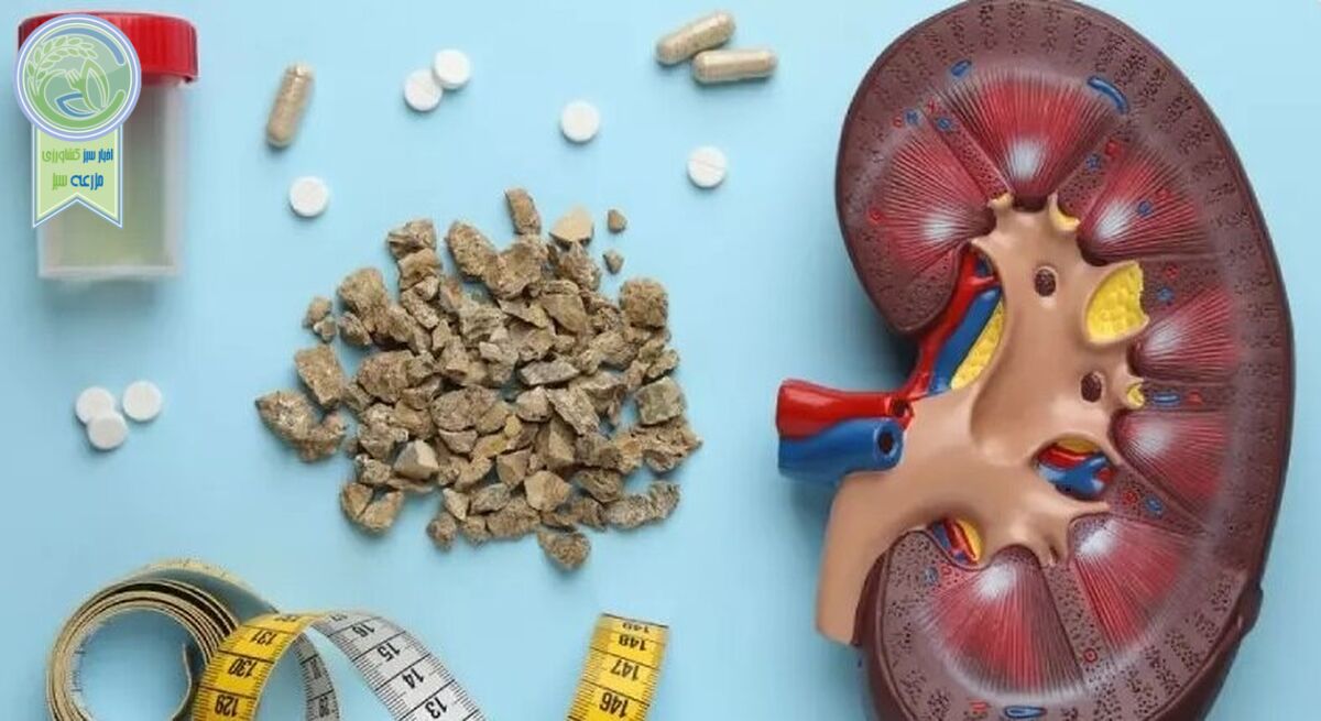 با این کارها از سنگ کلیه در امان بمانید

