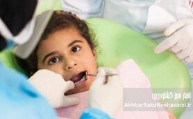 سلامت دهان و دندان ایرانیان؛ شاخص‌ها چه می‌گویند؟
