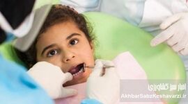 سلامت دهان و دندان ایرانیان؛ شاخص‌ها چه می‌گویند؟
