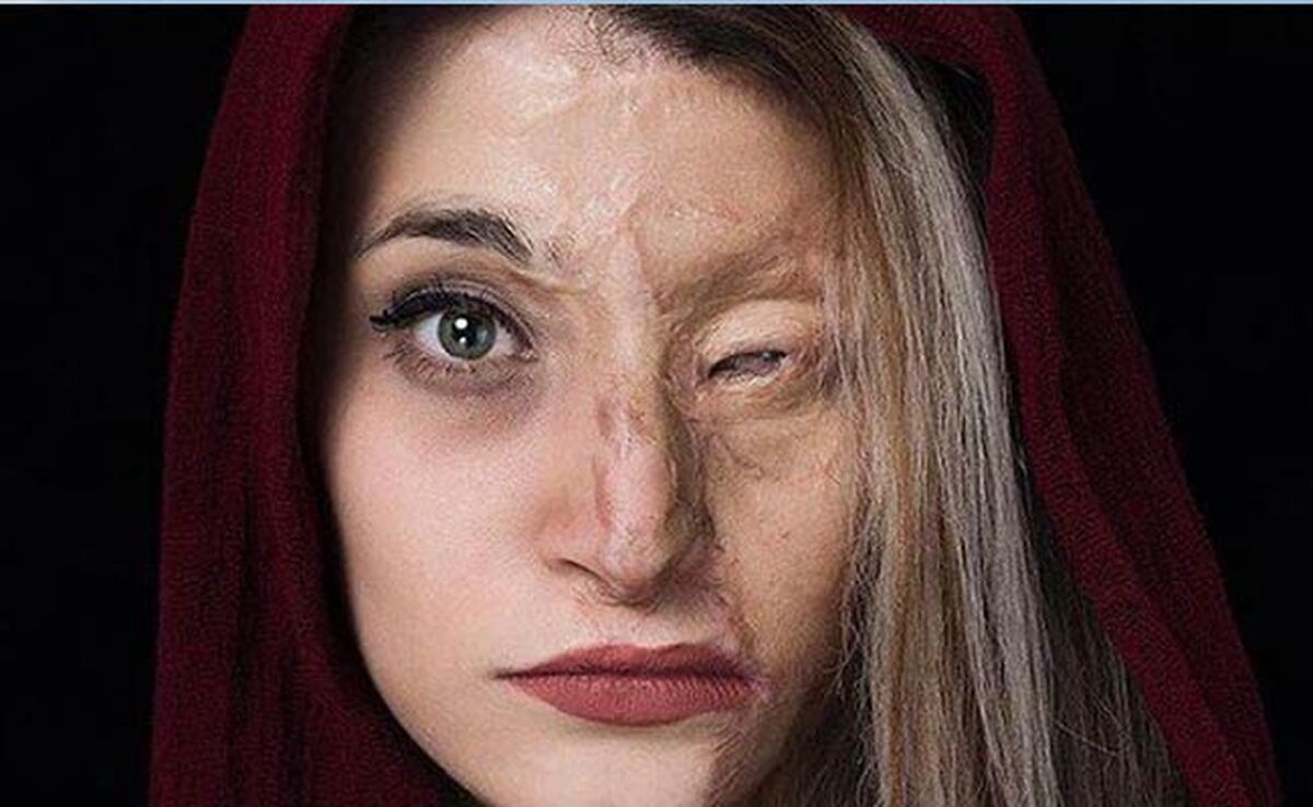 از لایحه منع خشونت علیه زنان چه خبر‌؟


