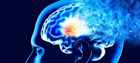 هوش مصنوعی چگونه آلزایمر را پیش‌بینی خواهد کرد؟

