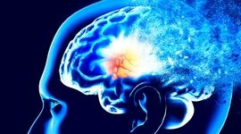 هوش مصنوعی چگونه آلزایمر را پیش‌بینی خواهد کرد؟

